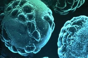 Caxumba e um virus ou bacteria