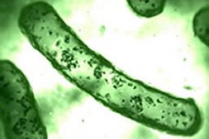 Mumps viral or bacterial