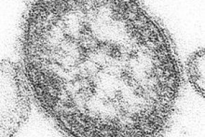 Sarampo e uma virus ou uma bacteria