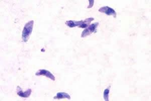 Toxoplasmose e virus ou bacteria